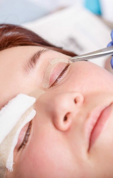 Eyelid surgery? Use scar cream!