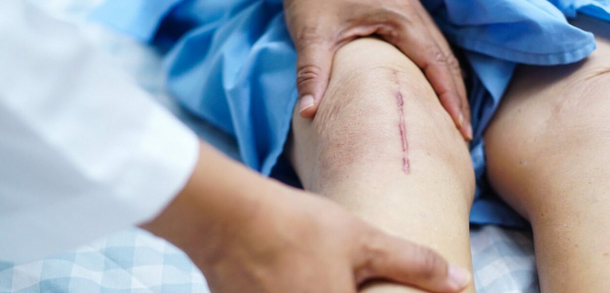 Best treatment for scar pain