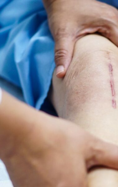 Best treatment for scar pain