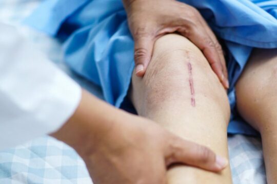 Best treatment for scar pain