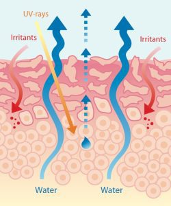 weakened skin barrier moisture loss UV rays and irritants penetrating sensitive skin