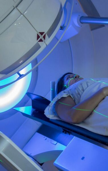 Which cream after radiation treatment