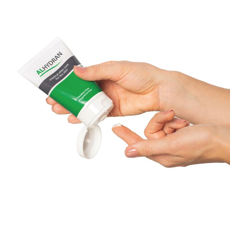 Application of Alhydran medical cream