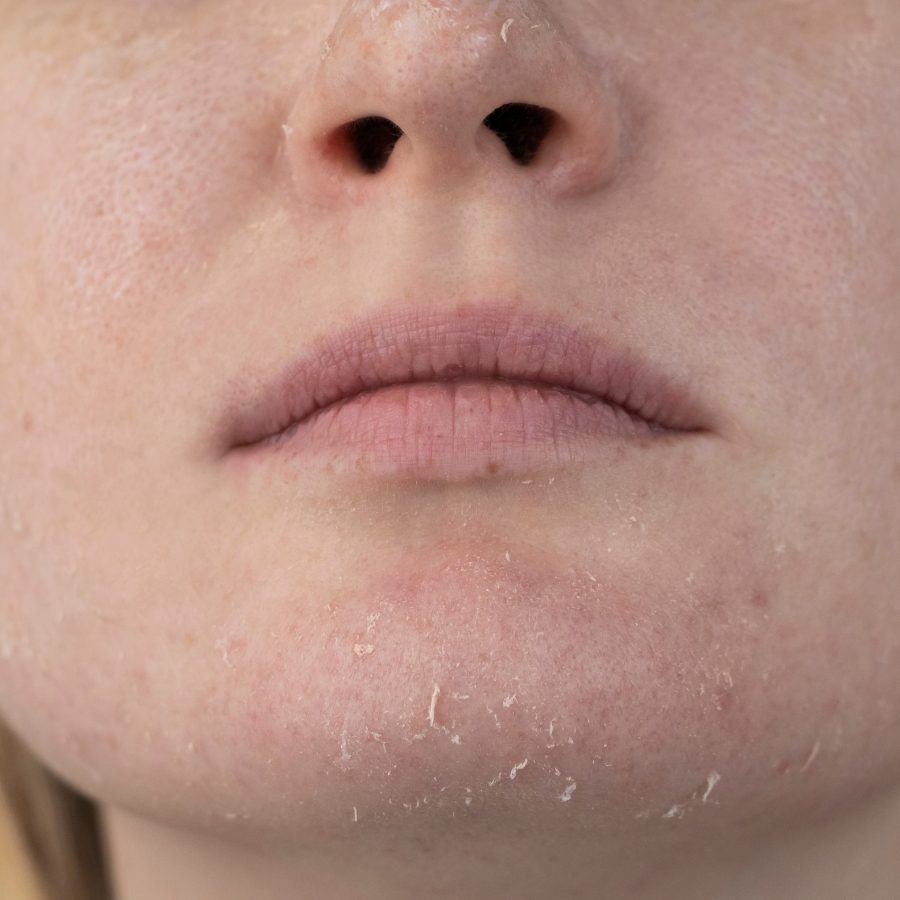 A Woman Examines Dry Skin on Her Face