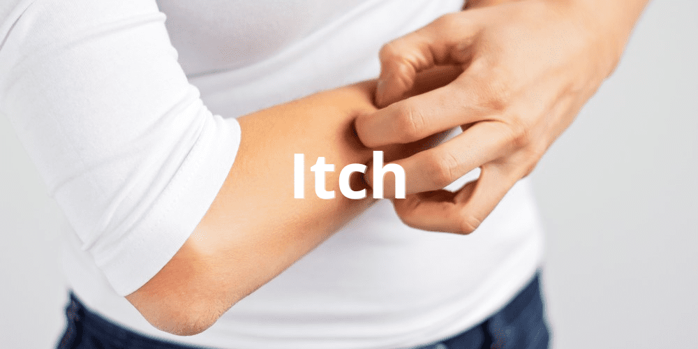 Itch