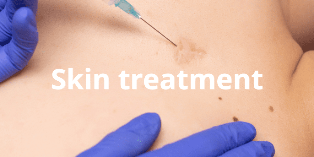 Skin treatment