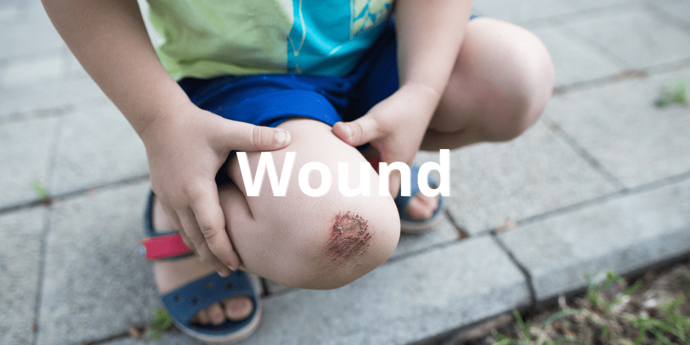 Wound