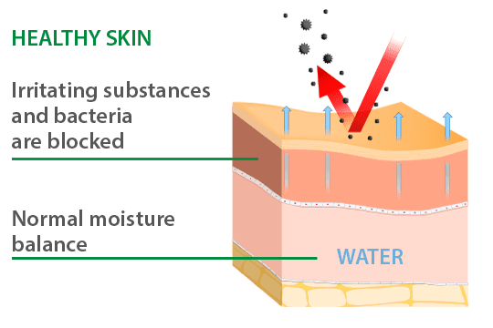 Diagram comparing healthy skin and eczema skin, showing how a damaged skin barrier allows irritants to enter and increases moisture loss: healthy skin